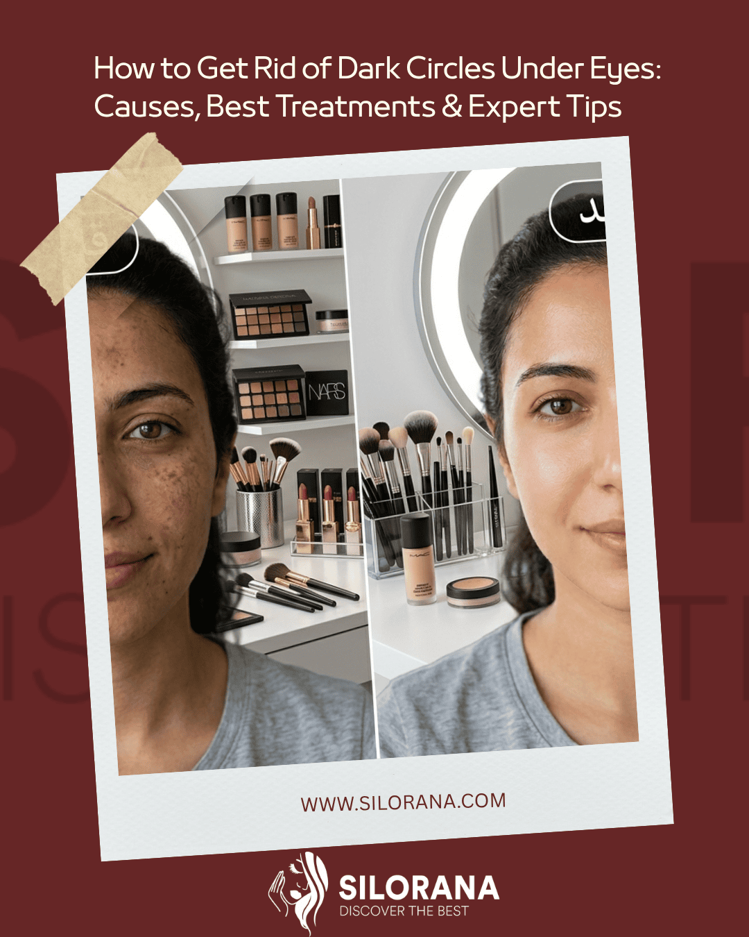 Dark Spots on Face: best 10 Causes